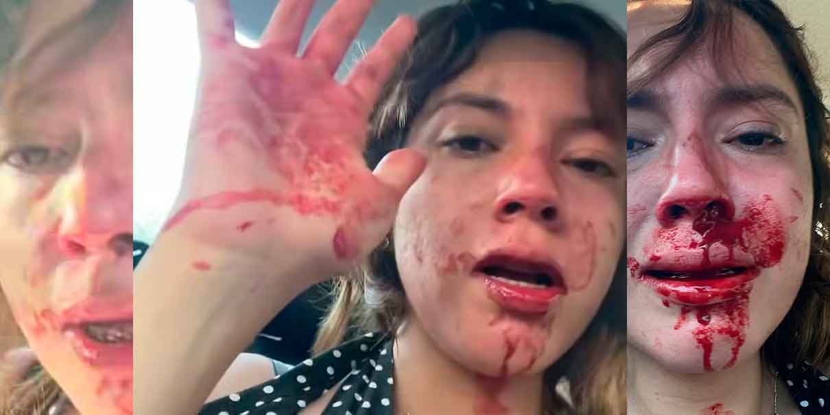 Jovencita denuncia brutal agresión de su novio en Cuernavaca durante su cumpleaños