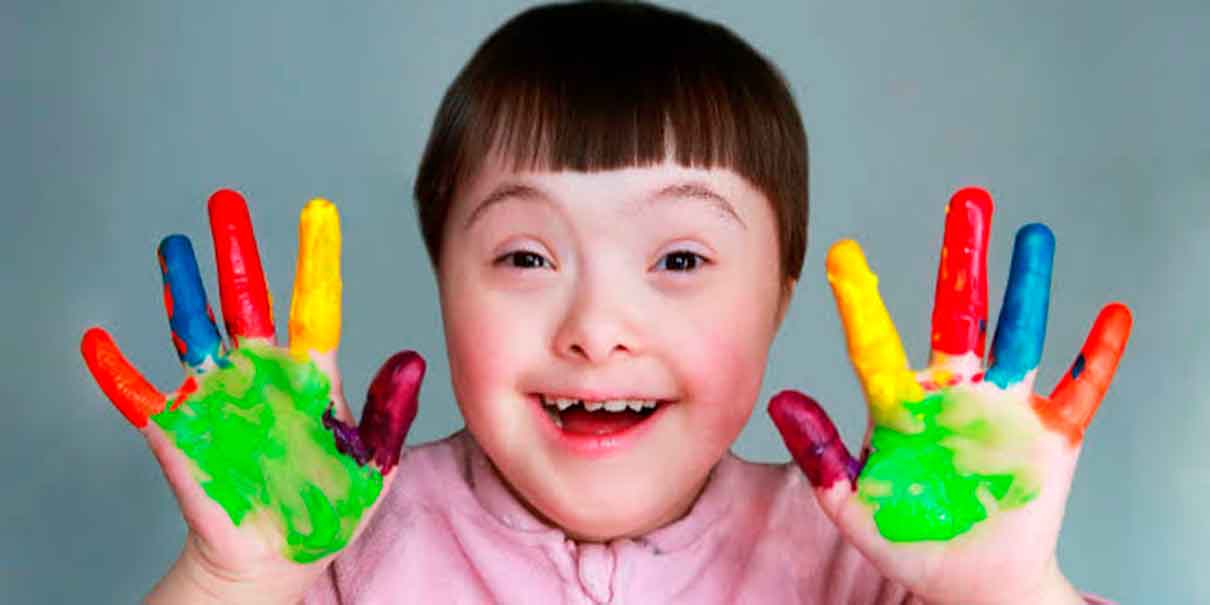 Síndrome de Down: la forma hereditaria que pocas personas conocen