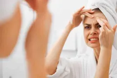 ¿El sudor causa acné? La verdad sobre los brotes en la piel durante el calor