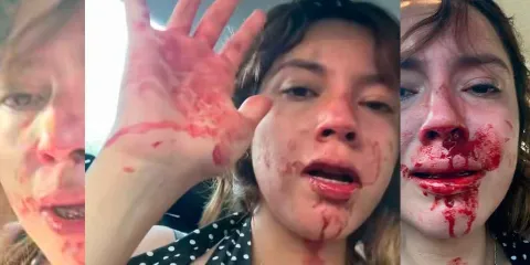 Jovencita denuncia brutal agresión de su novio en Cuernavaca durante su cumpleaños
