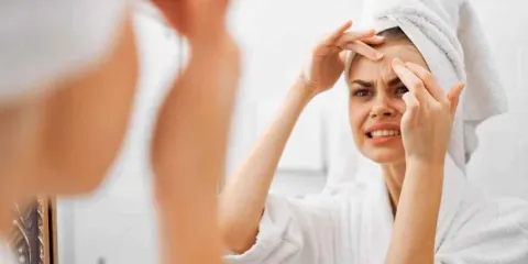 ¿El sudor causa acné? La verdad sobre los brotes en la piel durante el calor