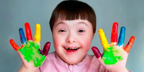 Síndrome de Down: la forma hereditaria que pocas personas conocen